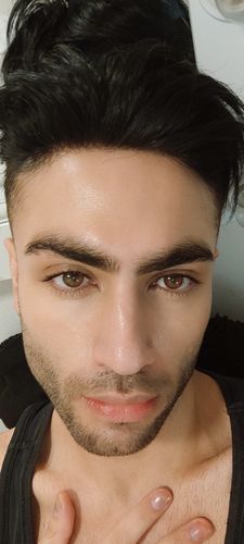 Customer photo review of EvenSkyn® Lumo: Premium Anti-Aging & Skin Tightening Handset