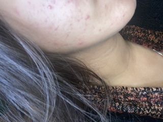 Customer photo review of Kumkumadi Oil