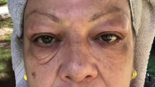 Customer photo review of Vibrant Glamour ™ Magic Eye Cream