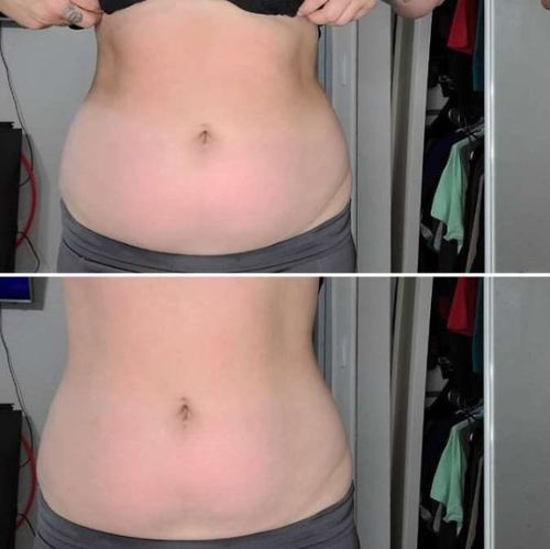 Customer photo review of Boldtique™ Bukdräneringsolja