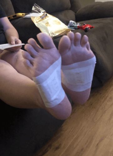 Customer photo review of Boldtique™ Anti-Swelling Ginger Detox Patch