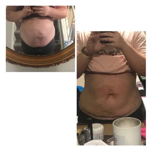 Customer photo review of Boldtique™ Bukdräneringsolja