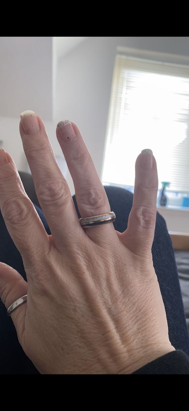 Customer photo review of The Rosie Black Wonder Ring