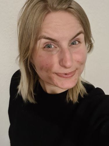 Customer photo review of Bio-Akne-Seife MaggyBeauty®