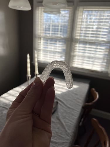 Customer photo review of Annual Plan – One night guard shipped every three months