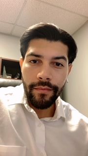 Customer photo review of TheSalonGuy TALC – Lightweight Hair Powder Spray with Matte Finish – 0.7oz