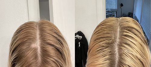 Customer photo review of Boldtique™ Hårroller Serum