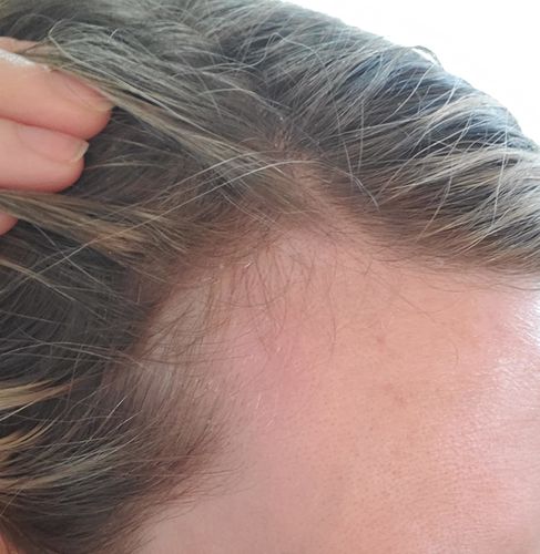 Customer photo review of Boldtique™ Hårroller Serum