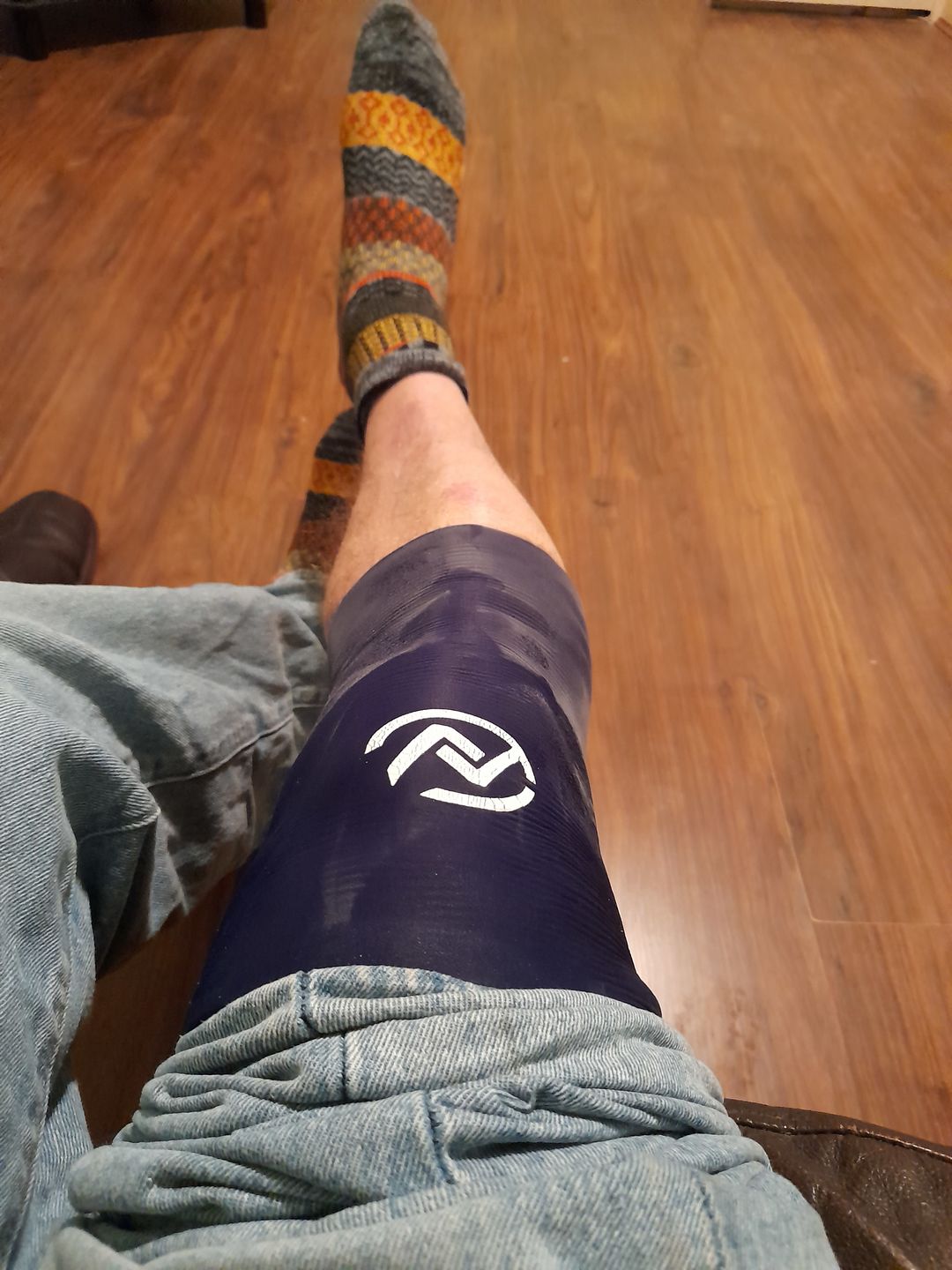 Customer photo review of COCOON KNEE FLEX PRO