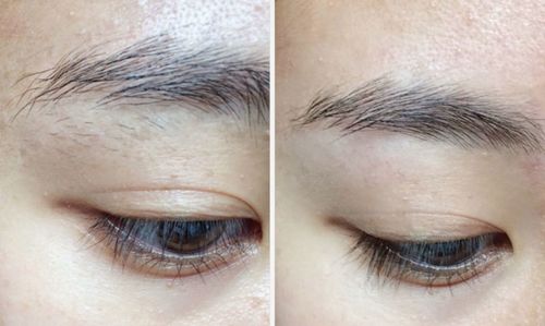 Customer photo review of EpiBrow™ Eyebrow Epilator PRO Enkel och Snabb Borttagning av Oönskat Hår Utan Höga Salongskostnader.