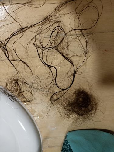 Customer photo review of Pack Hair et Skin - 3 mois