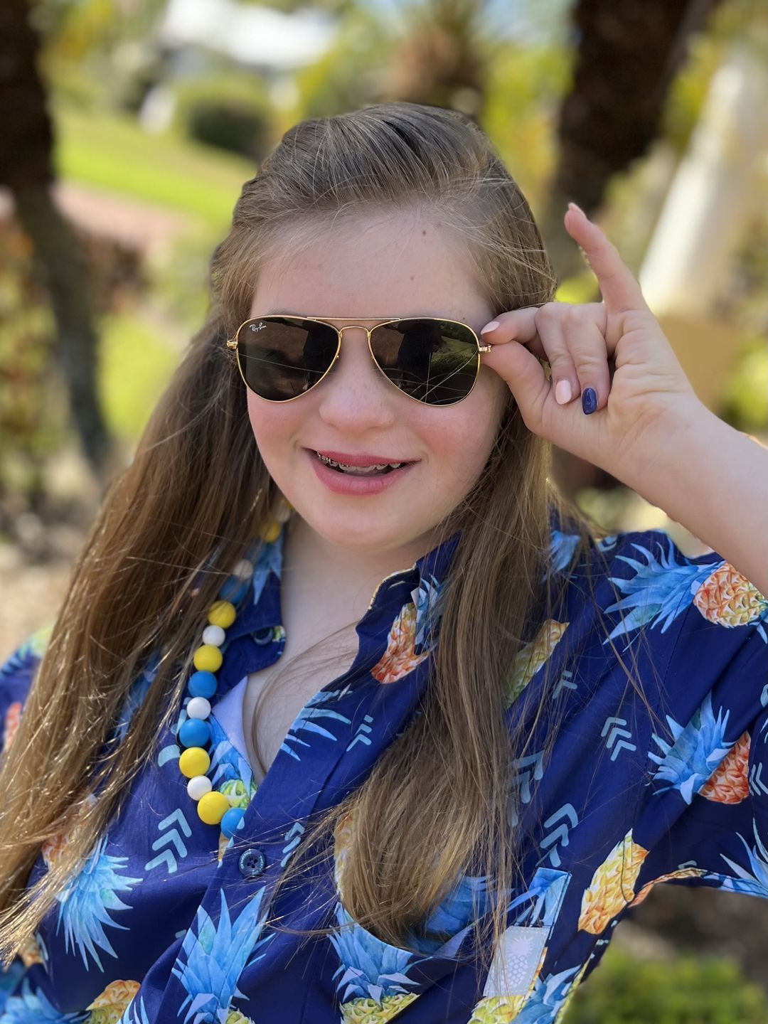Customer photo review of PRE-ORDER ONLY 21 Pineapples Signature Button Up Shirt - ARRIVING JANUARY 2022
