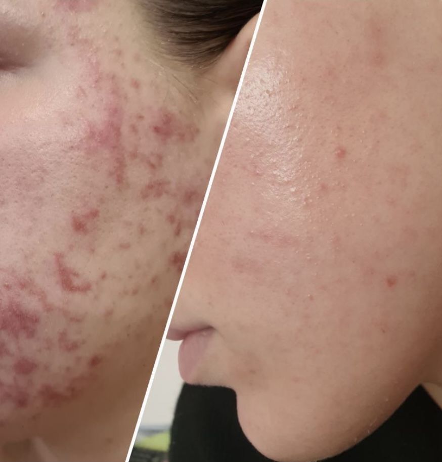 Customer photo review of Sleek Skin Serum 30ml