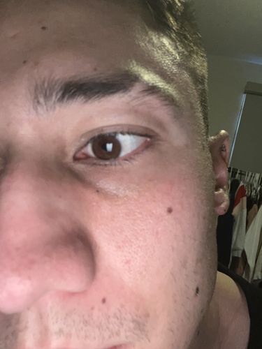 Customer photo review of Quartz Prescription Monthly Colored Contact Lenses