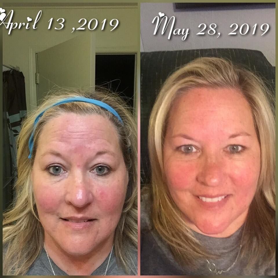 Customer photo review of Deluxe Set