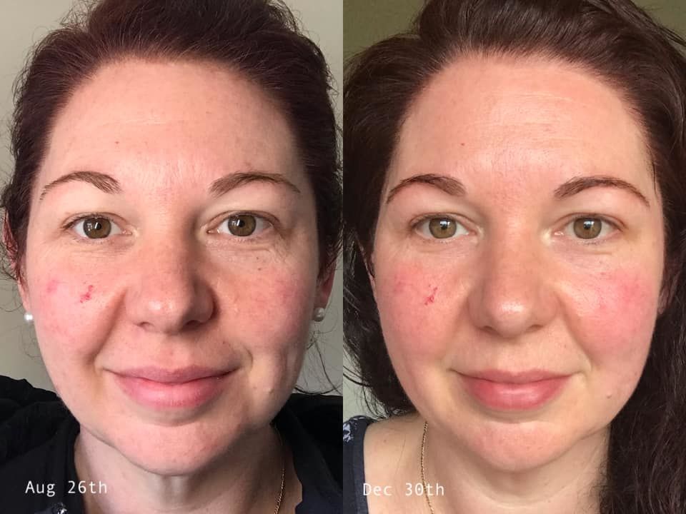 Customer photo review of Deluxe Set