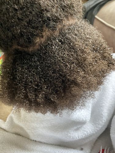 Customer photo review of Hair Recovery Bundle