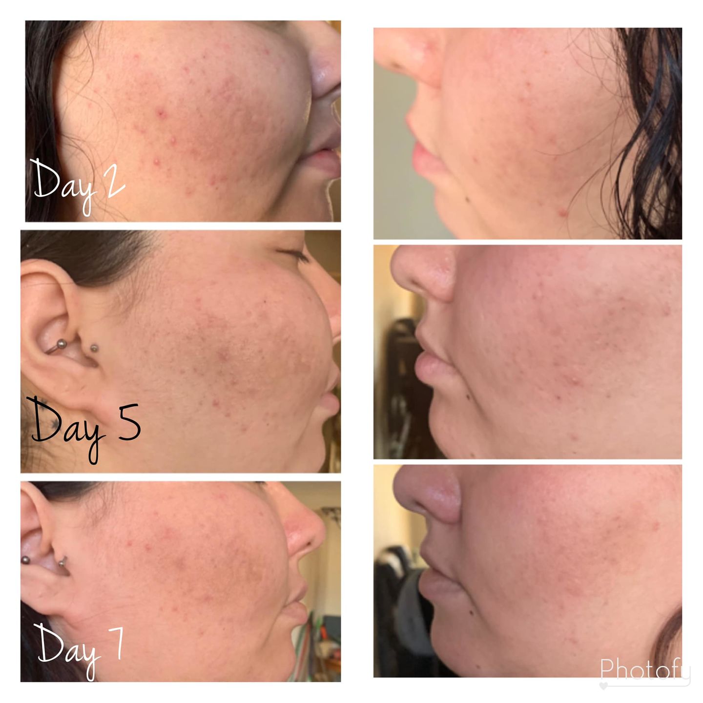 Customer photo review of Deluxe Set