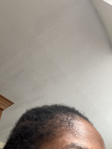 Customer photo review of Hair Growth Potion - Extra Strength