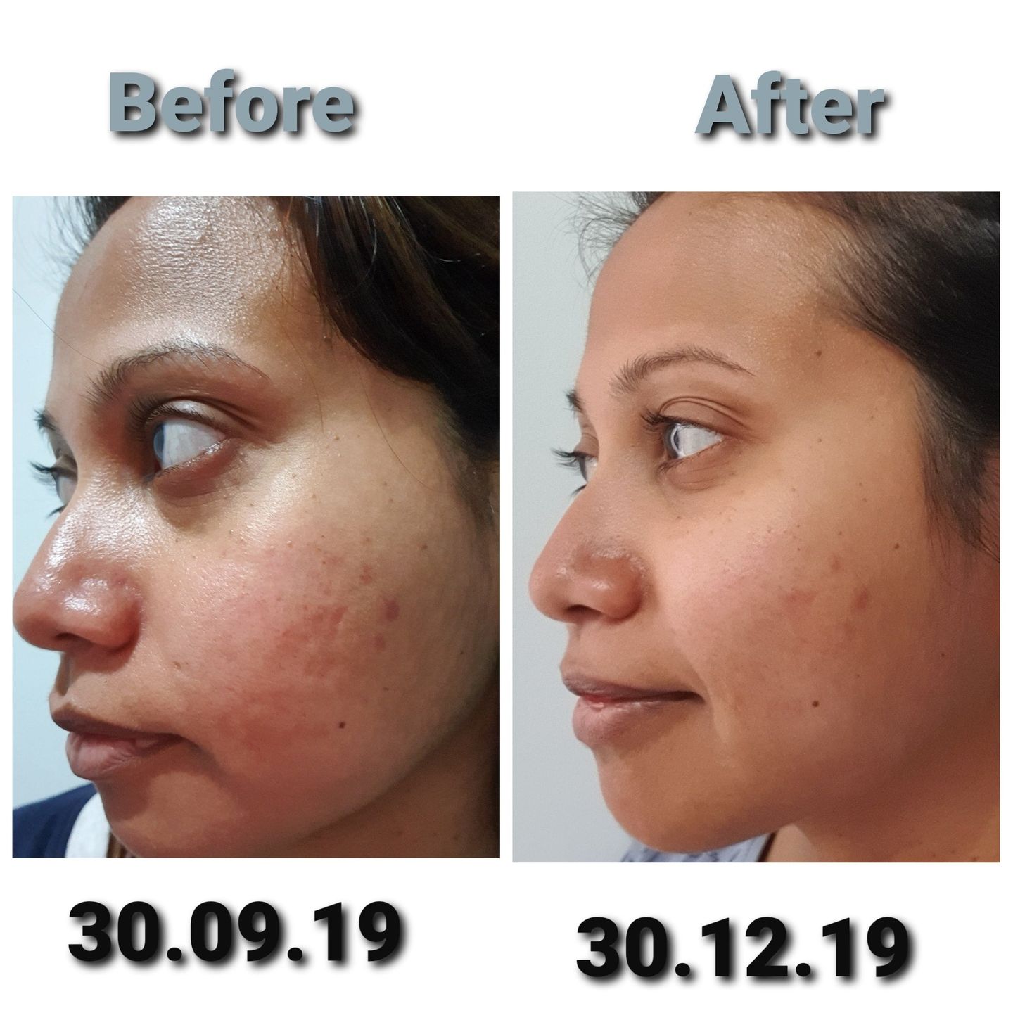 Customer photo review of Deluxe Set