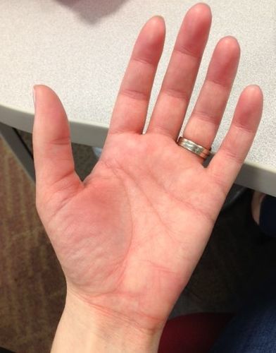 Customer photo review of LymphDetox Ginger Essential Oil