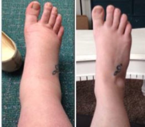 Customer photo review of LymphDetox Ginger Essential Oil