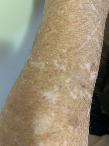 Customer photo review of 1 x Black Slate Base + 1 x Pryshan Clay Stone Set