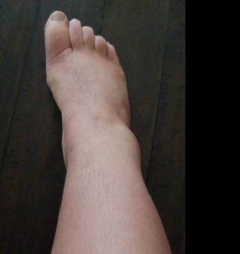 Customer photo review of LymphDetox Ginger Essential Oil