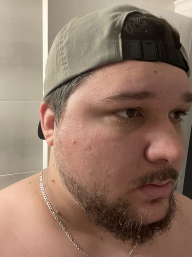Customer photo review of Big Ultralight Cap, Grey/Yellow