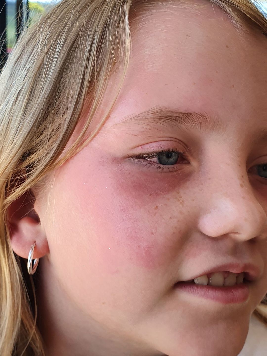 Customer photo review of Wild Bee Illuminating Face Mask
