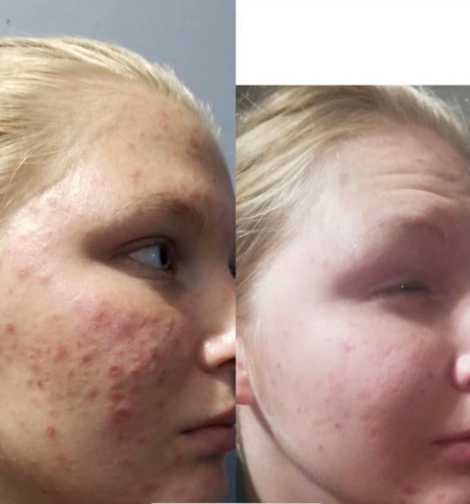 Customer photo review of Deluxe Set