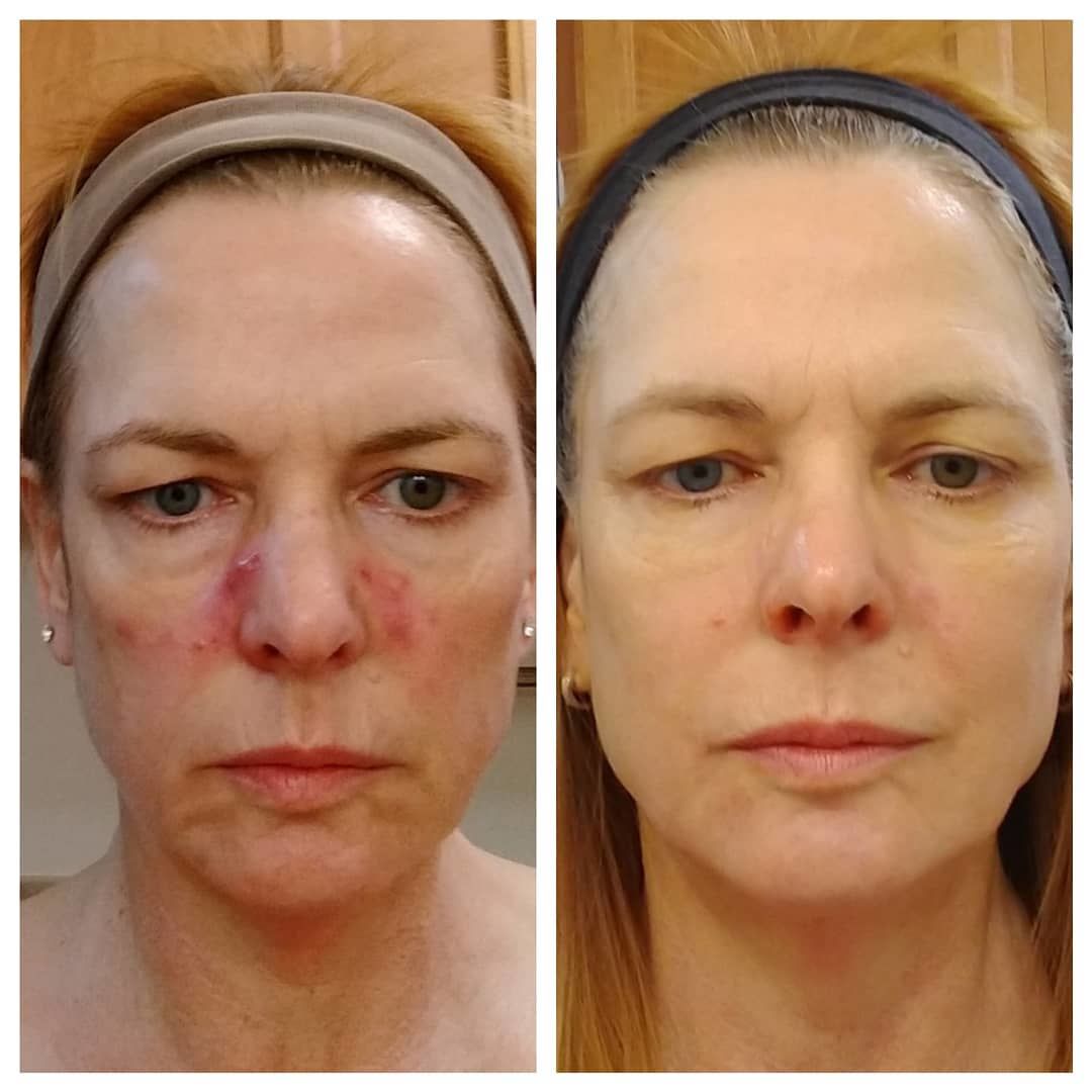 Customer photo review of Deluxe Set