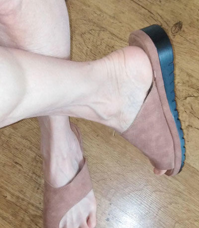 Customer photo review of Sandales Orthopédiques correctrices des Oignons - Hallux Valgus - Gros Orteil