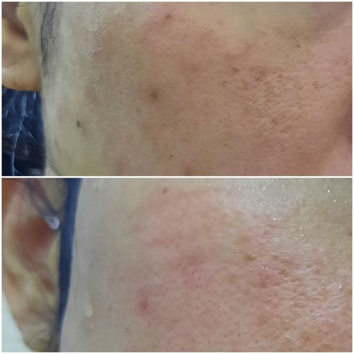 Customer photo review of Booster Set