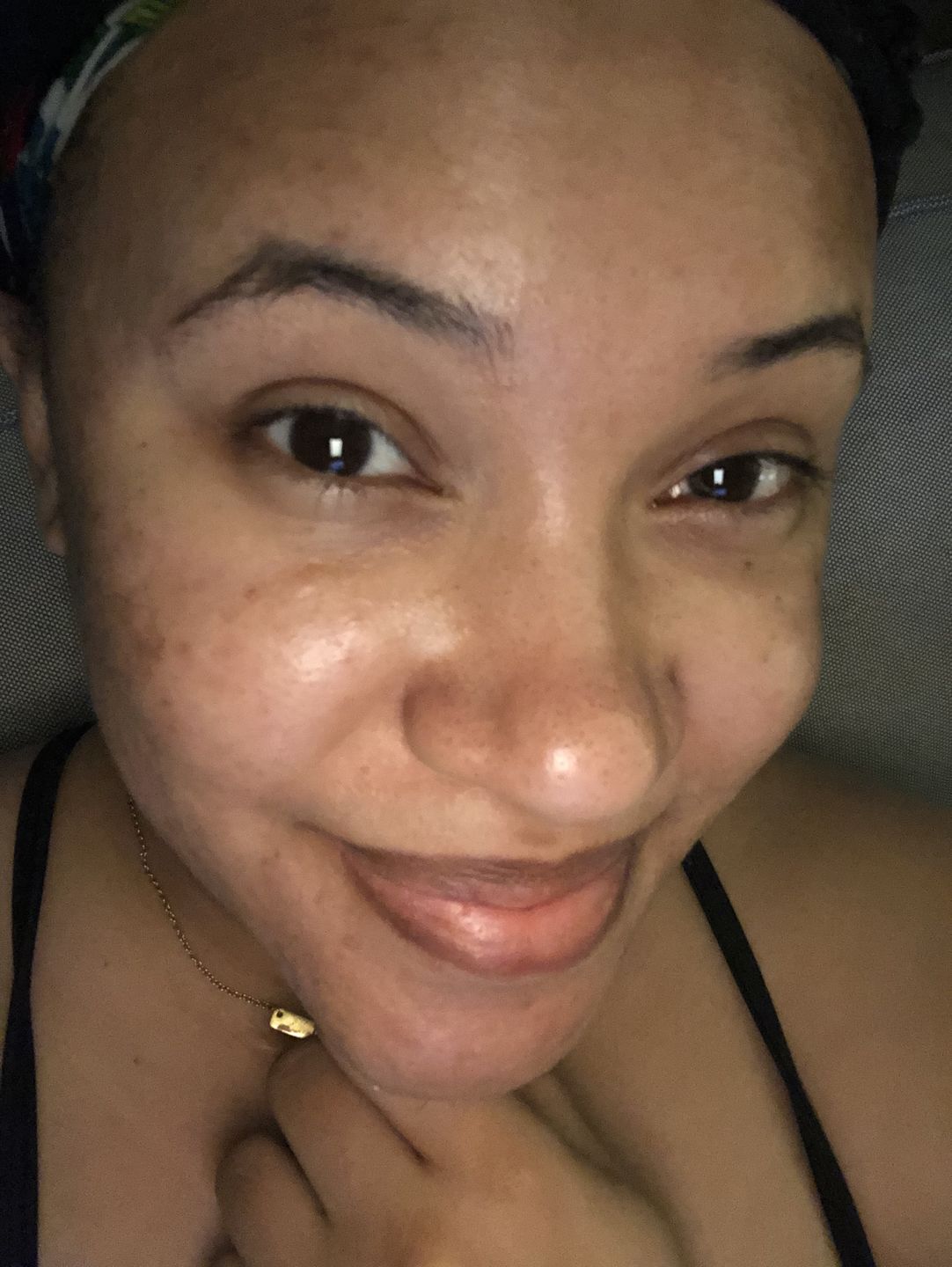 Customer photo review of Bolden Clear Skin Kit