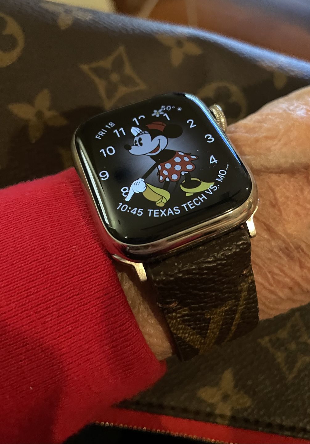 Customer photo review of Apple Watch Band Classic LV Monogram