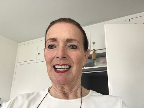 Customer photo review of Tooth-Veneer