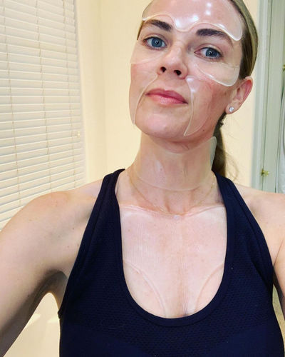 Customer photo review of Superlift™ Silicone Patches