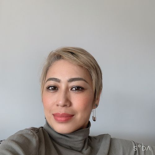 Customer photo review of Hyaluid