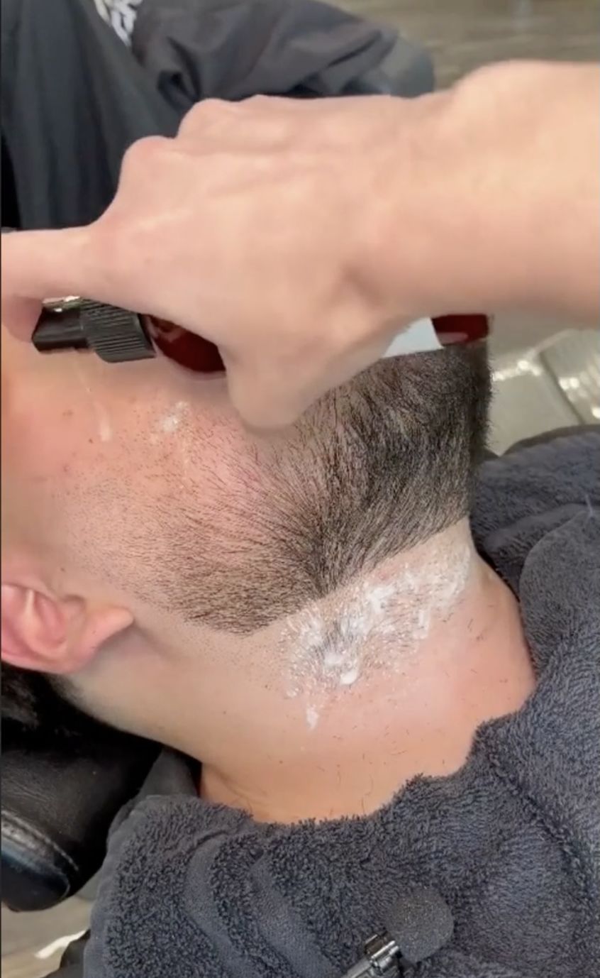 Customer photo review of PRO SHAVE SOLUTION (4 oz)