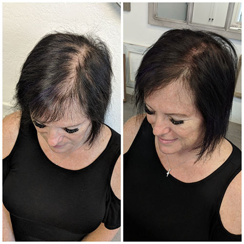 Customer photo review of Boldtique™ Anti-Grått Roller Hårserum