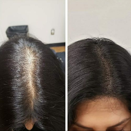 Customer photo review of Boldtique™ Anti-Grått Roller Hårserum