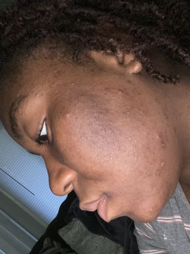 Danielle H. review of Qasil Powder for Hair and Skin, Organic Qasil Powder, Qasil Powder for Face, Pack of 1, 70gm image 1 out of 1