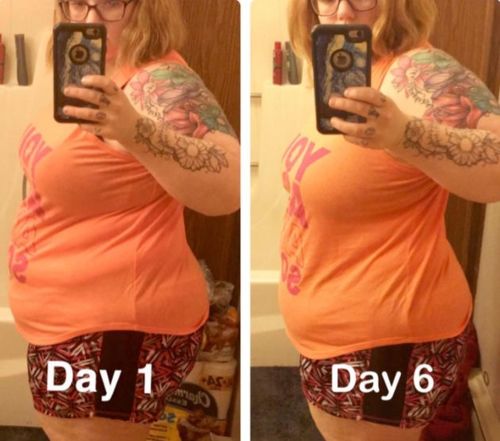 Customer photo review of 🔥Buy 2 Get 1 Free🔥Lymph Detoxification Ginger Oil