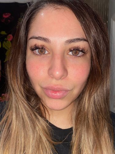 Customer photo review of Neala Brown Contact Lenses(12 months wear)