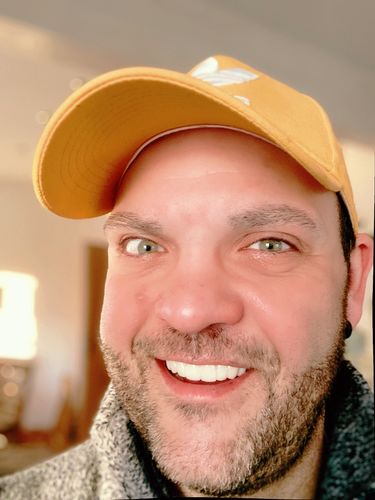 Customer photo review of Tooth-Veneer 2.0