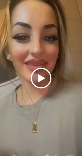 Customer video review of Tooth-Veneer 2.0