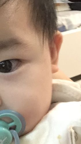 Customer photo review of Coco 清爽保濕套裝 (濕疹修護霜+蘆薈舒緩保濕凝膠)