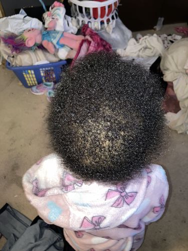 Customer photo review of Kid's Super healthy Hair kit