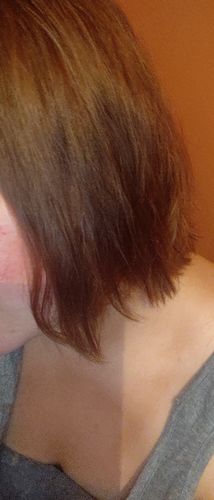 Customer photo review of SUBLIMIA HAIR DD SERUM 150 ML